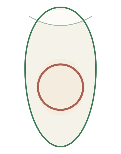 Anel de sangue